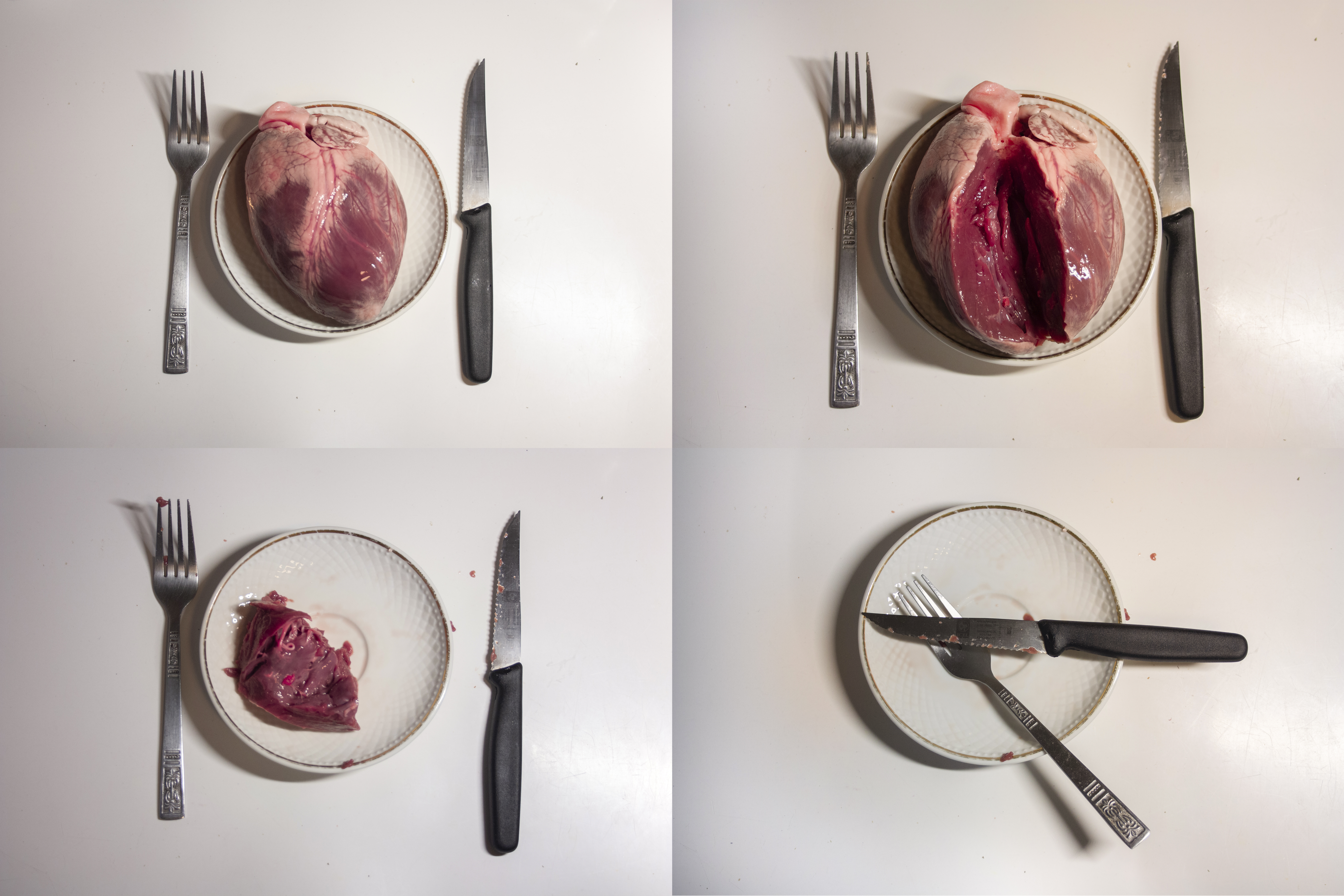 Serie open heart